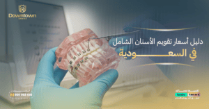 دليل أسعار تقويم الأسنان الشامل في السعودية 2026