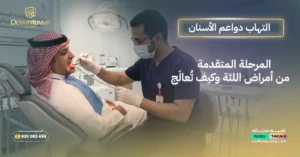 التهاب دواعم الأسنان – المرحلة المتقدمة من أمراض اللثة وكيف تُعالَج