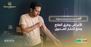 الجرب الأعراض وطرق العلاج ومنع انتشار العدوى
