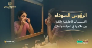 الرؤوس السوداء الأسباب الحقيقية والفرق بين علاجها في العيادة والمنزل