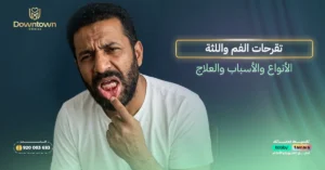 تقرحات الفم واللثة - الأنواع والأسباب والعلاج