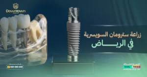 زراعة سترومان السويسرية في الرياض