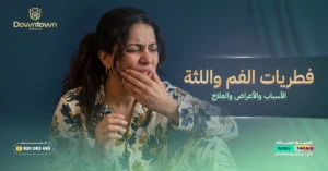 فطريات الفم واللثة - الأسباب والأعراض والعلاج