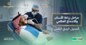 مراحل زراعة الأسنان والاندماج العظمي الجدول الزمني الكامل