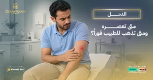 الدمل متى تعصره ومتى تذهب للطبيب فوراً؟