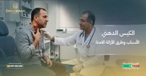 الكيس الدهني الأسباب وطرق الإزالة الآمنة