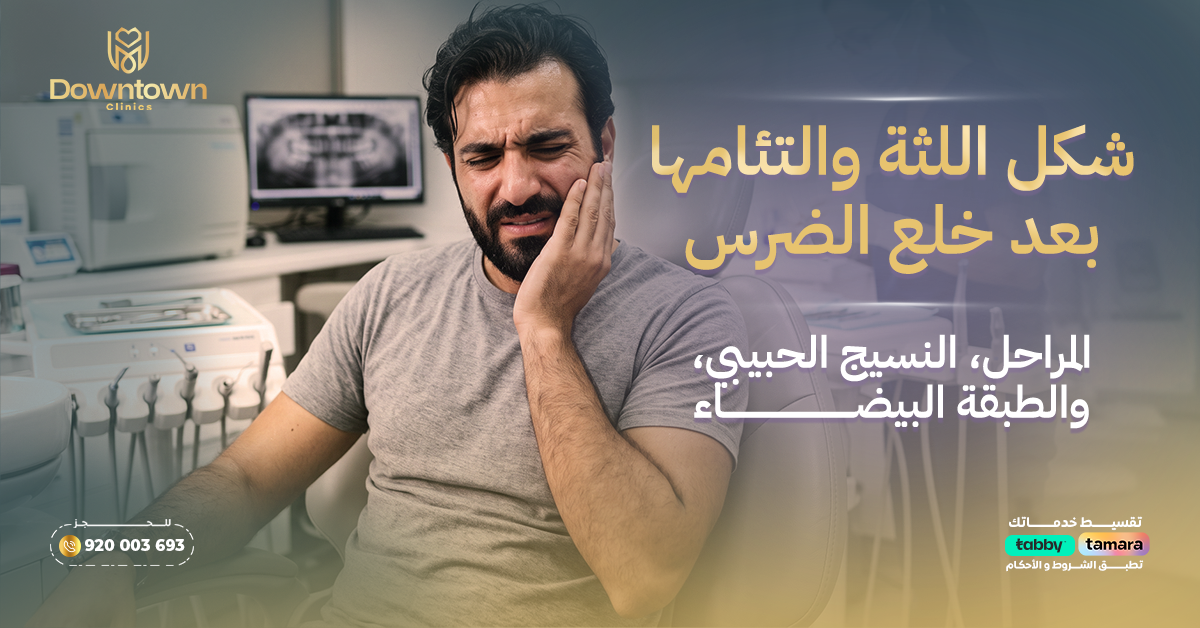 شكل اللثة والتئامها بعد خلع الضرس: المراحل، النسيج الحبيبي، والطبقة البيضاء