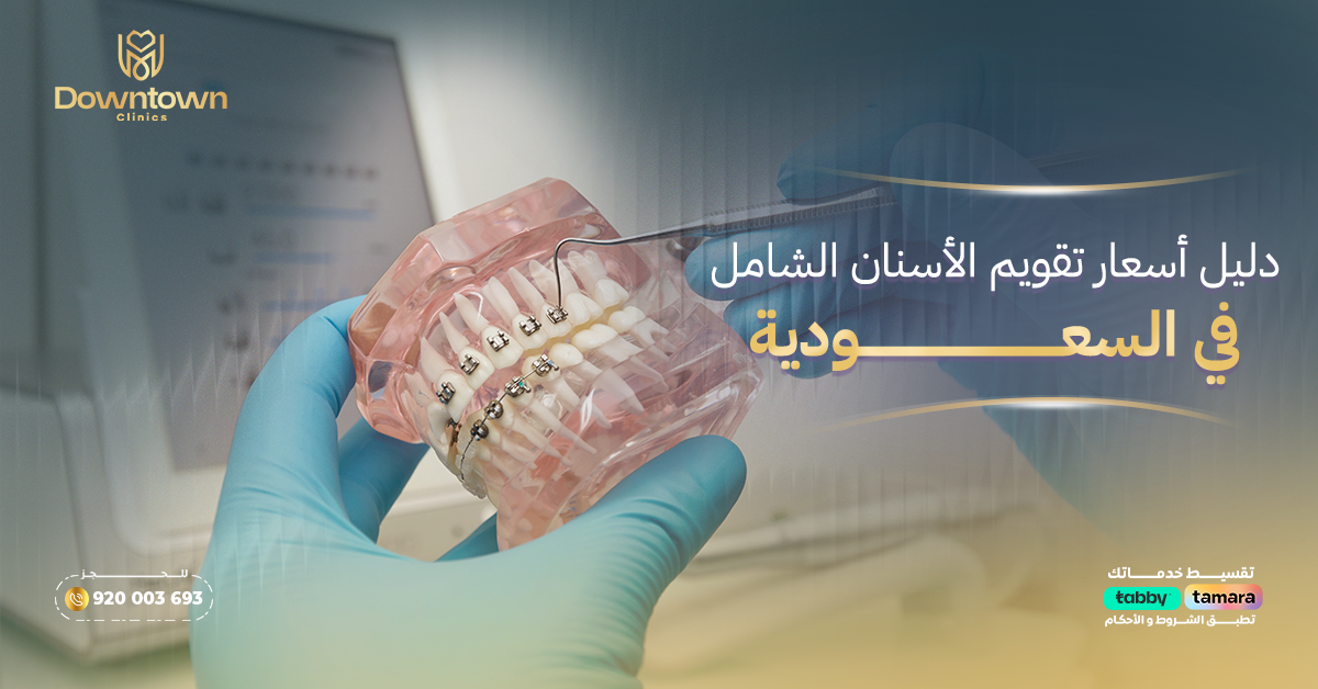دليل أسعار تقويم الأسنان الشامل في السعودية 2026