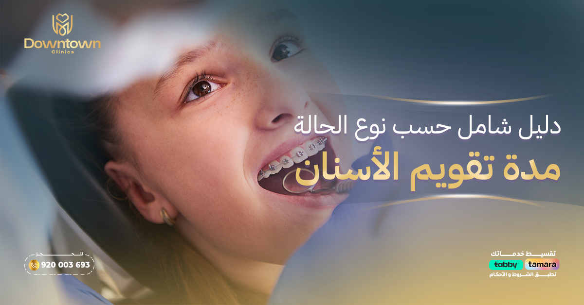 مدة تقويم الأسنان: دليل شامل حسب نوع الحالة