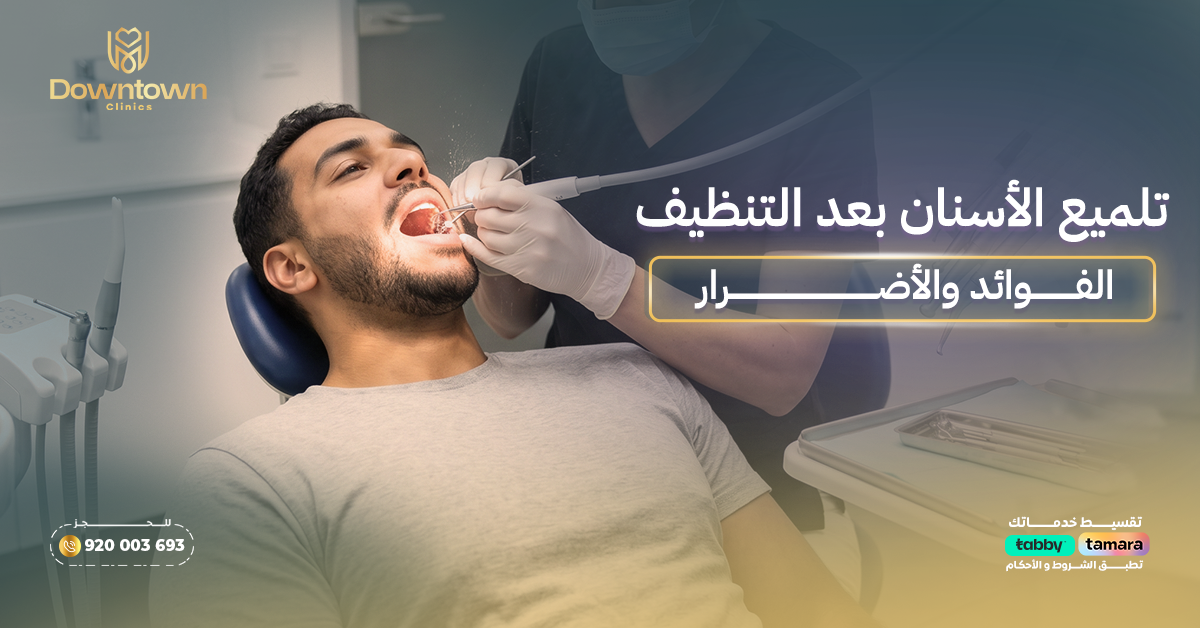 تلميع الأسنان بعد التنظيف — الفوائد والأضرار