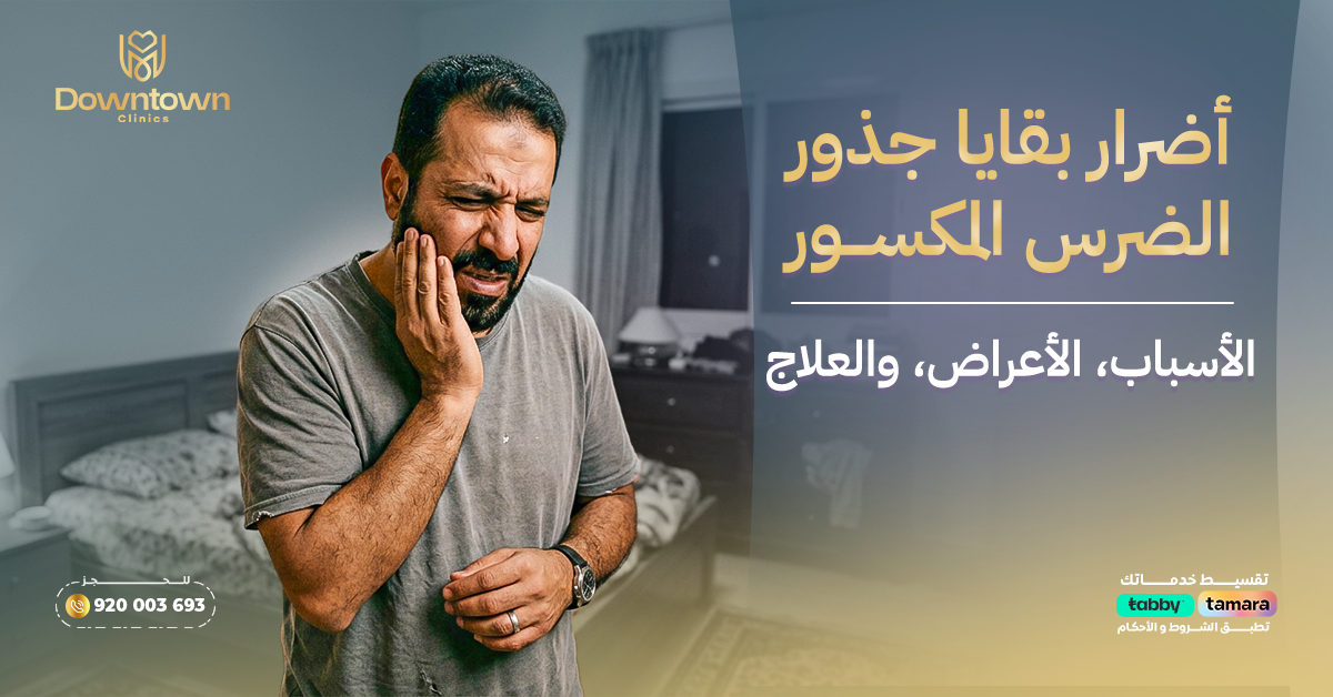 أضرار بقايا جذور الضرس المكسور الأسباب، الأعراض، والعلاج