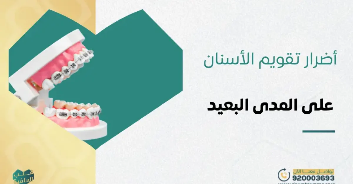 أضرار تقويم الأسنان على المدى البعيد