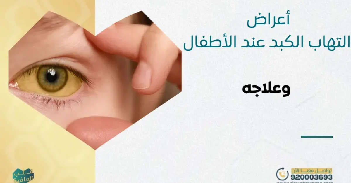 أعراض التهاب الكبد عند الأطفال وعلاجه