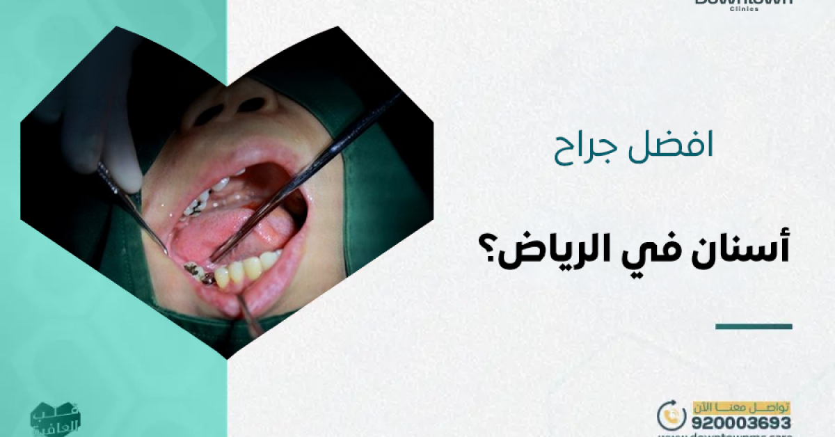 أفضل جراح أسنان في الرياض