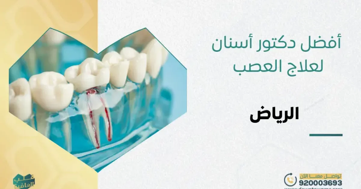 أفضل دكتور أسنان لعلاج العصب الرياض