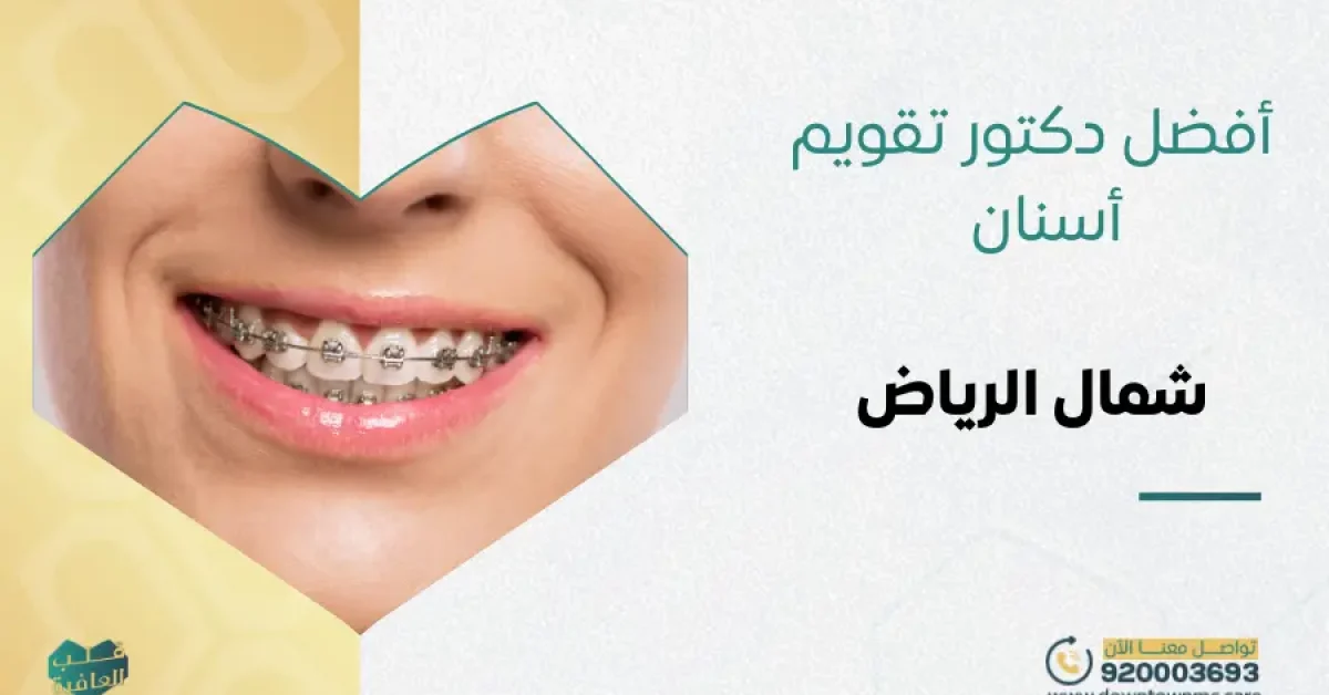 أفضل دكتور تقويم أسنان شمال الرياض