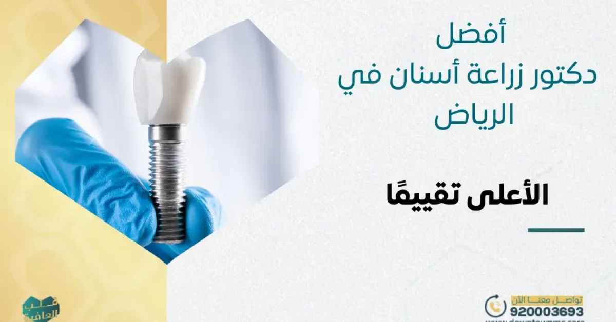 أفضل دكتور زراعة أسنان في الرياض الأعلى تقييمًا
