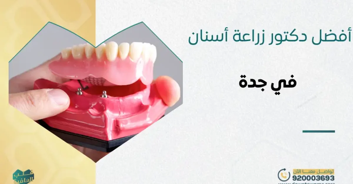 أفضل دكتور زراعة أسنان في جدة