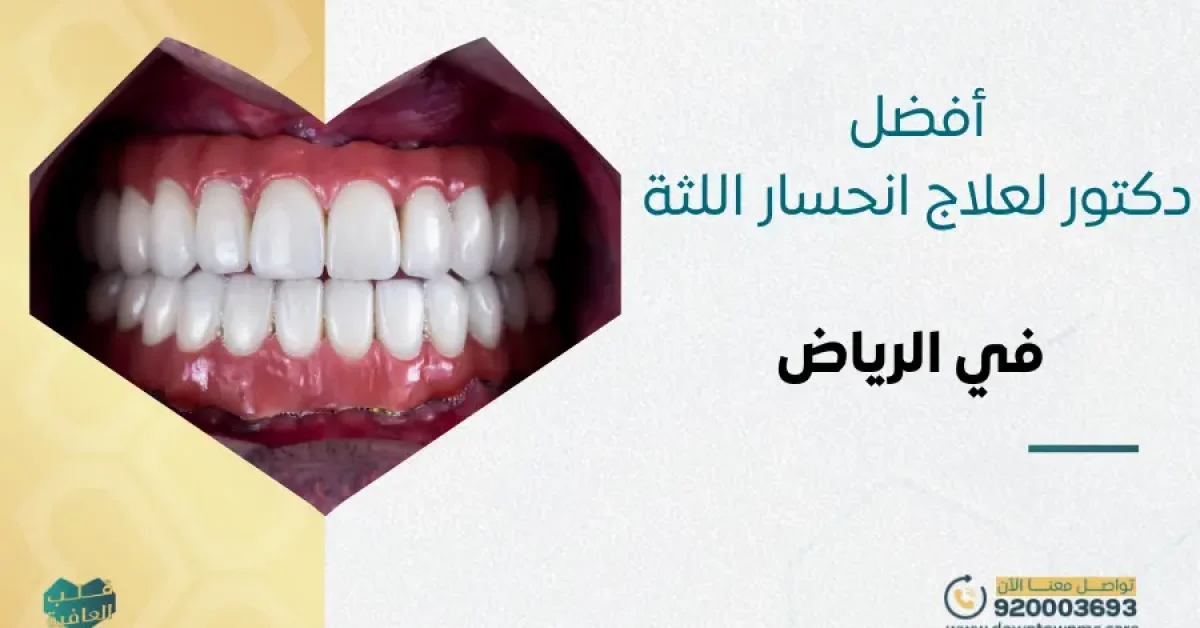 أفضل دكتور لعلاج انحسار اللثة في الرياض