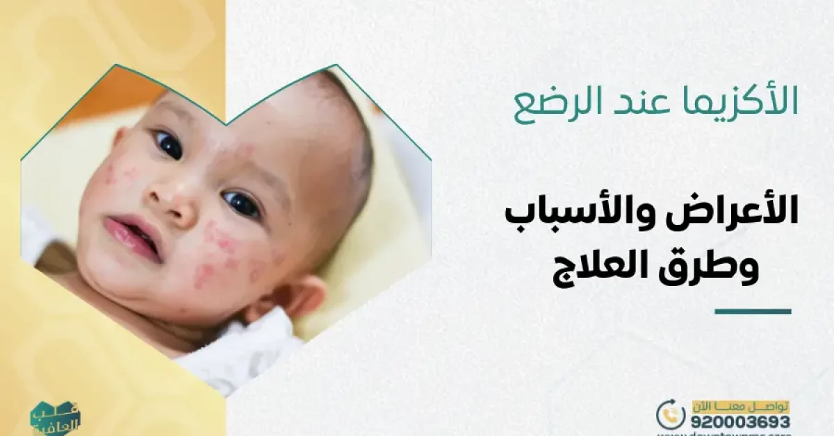 الأكزيما عند الرضع