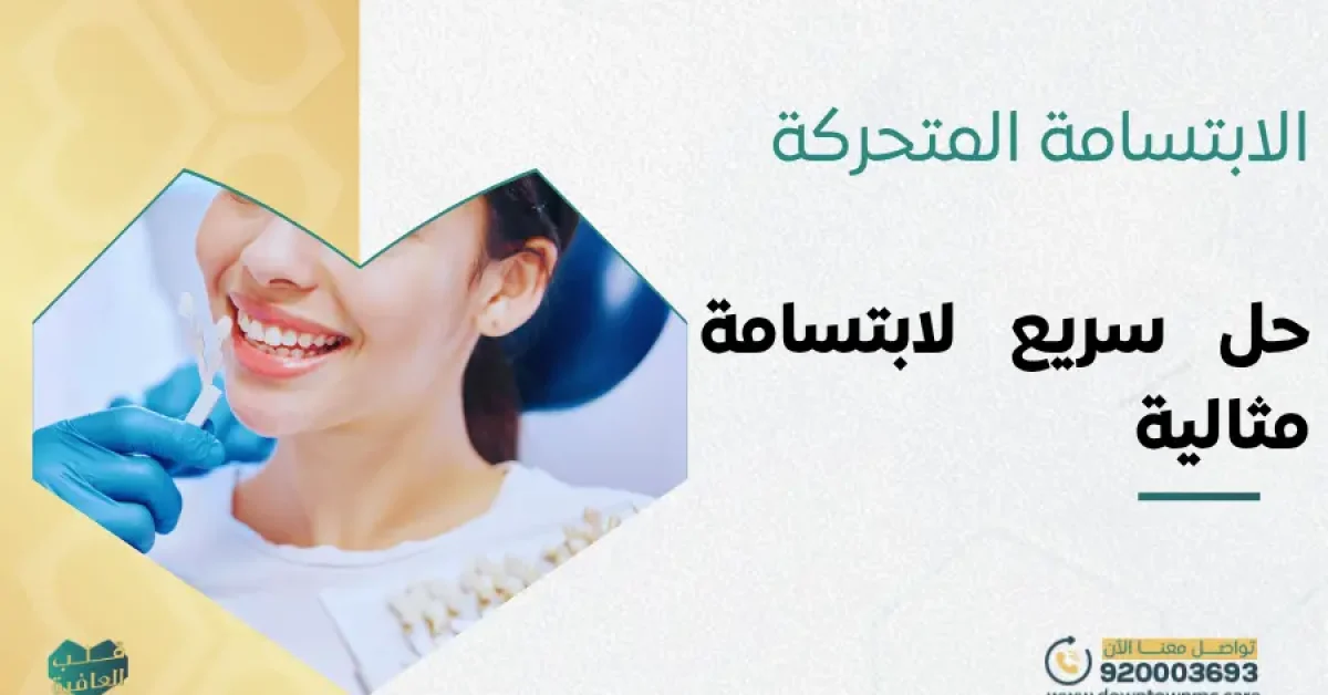 الابتسامة المتحركة
