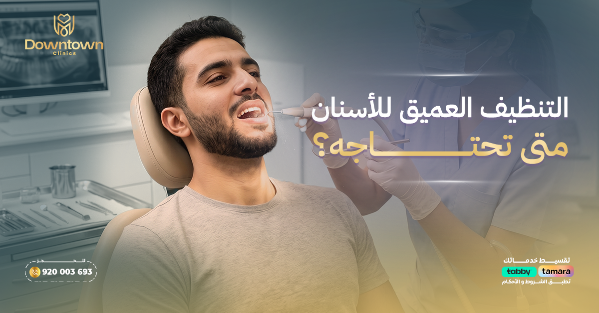 التنظيف العميق للأسنان متى تحتاجينه؟ عيادات داون تاون