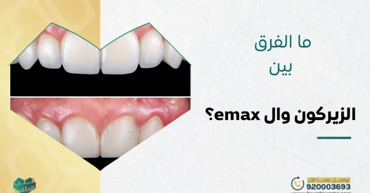 الفرق بين الزيركون وال emax