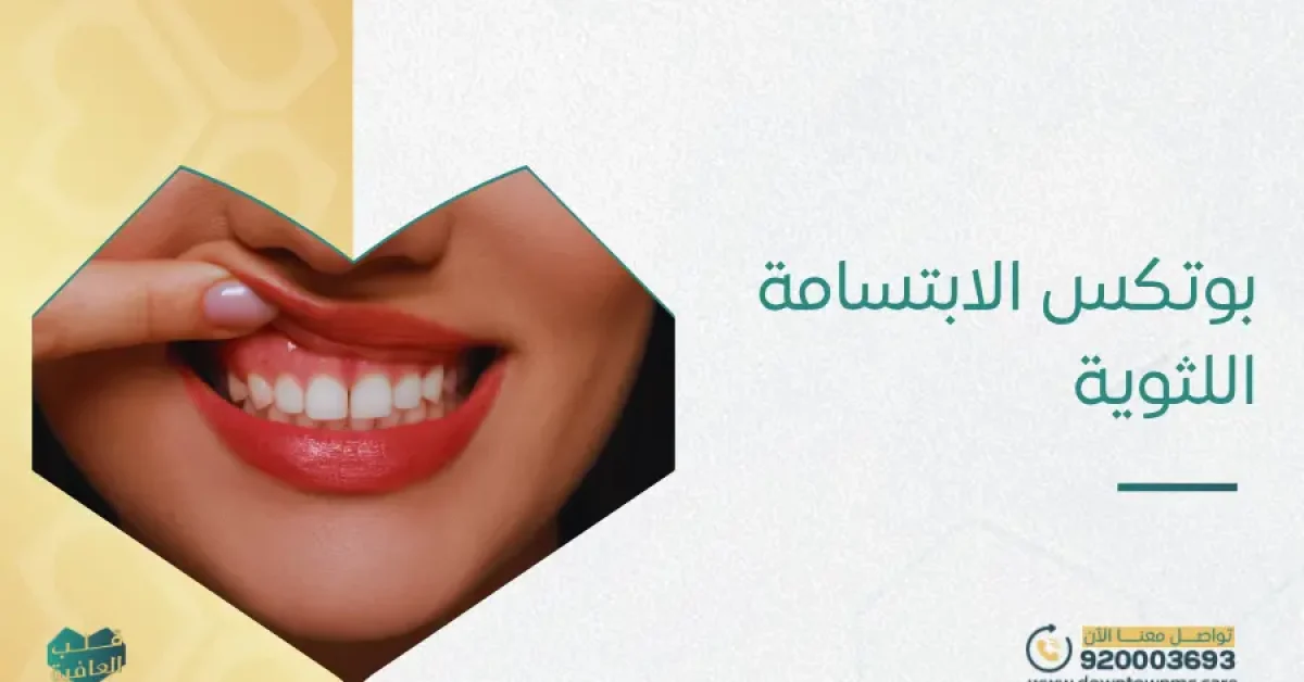 بوتكس الابتسامة اللثوية