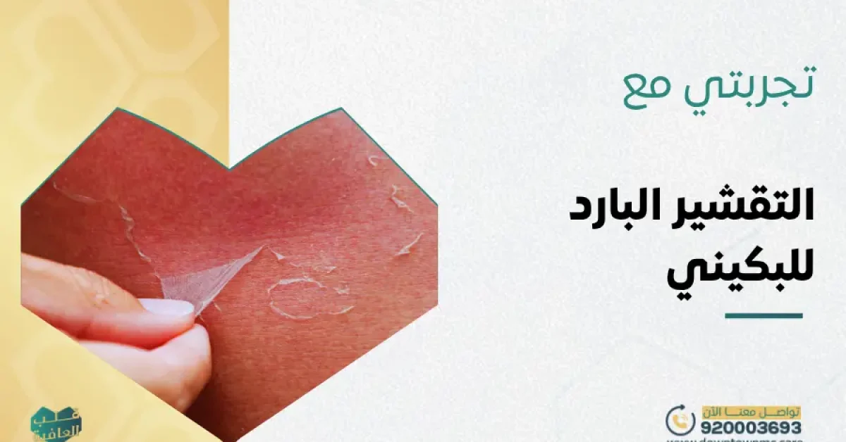 تجربتي مع التقشير البارد للبكيني