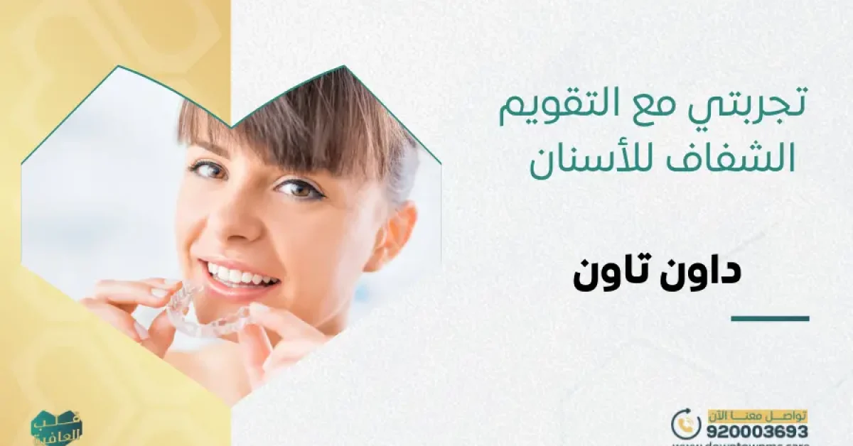 تجربتي مع التقويم الشفاف
