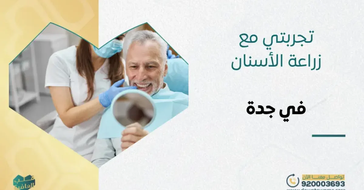 تجربتي مع زراعة الأسنان في جدة