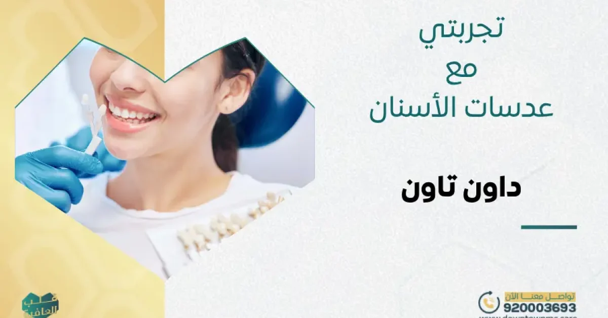 تجربتي مع عدسات الأسنان بدون نحت في داون تاون
