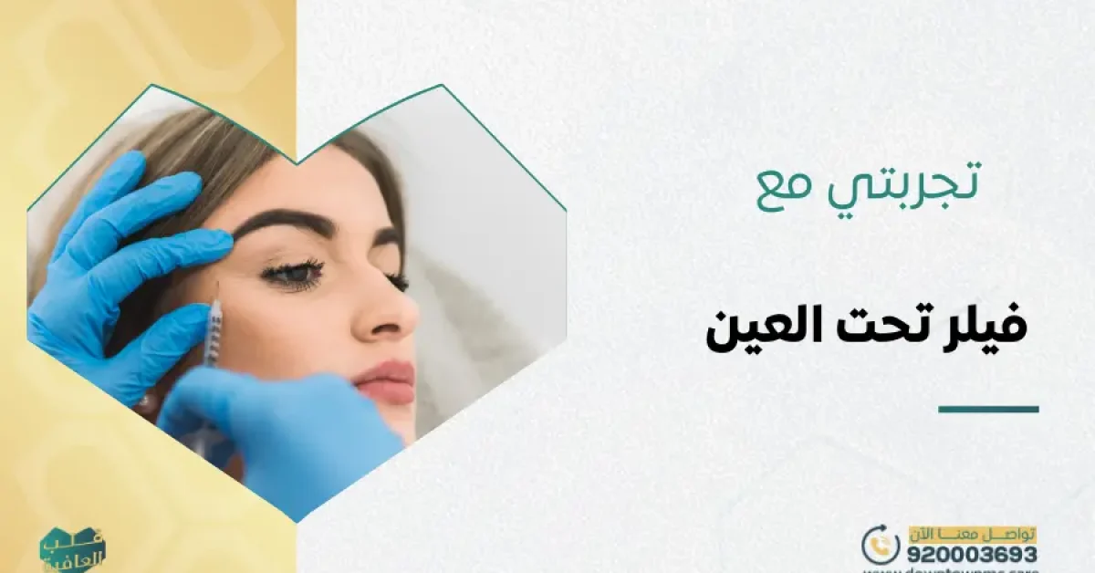 تجربتي مع فيلر تحت العين