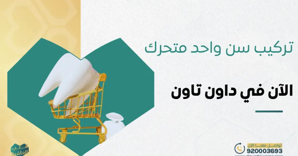 تركيب سن واحد متحرك