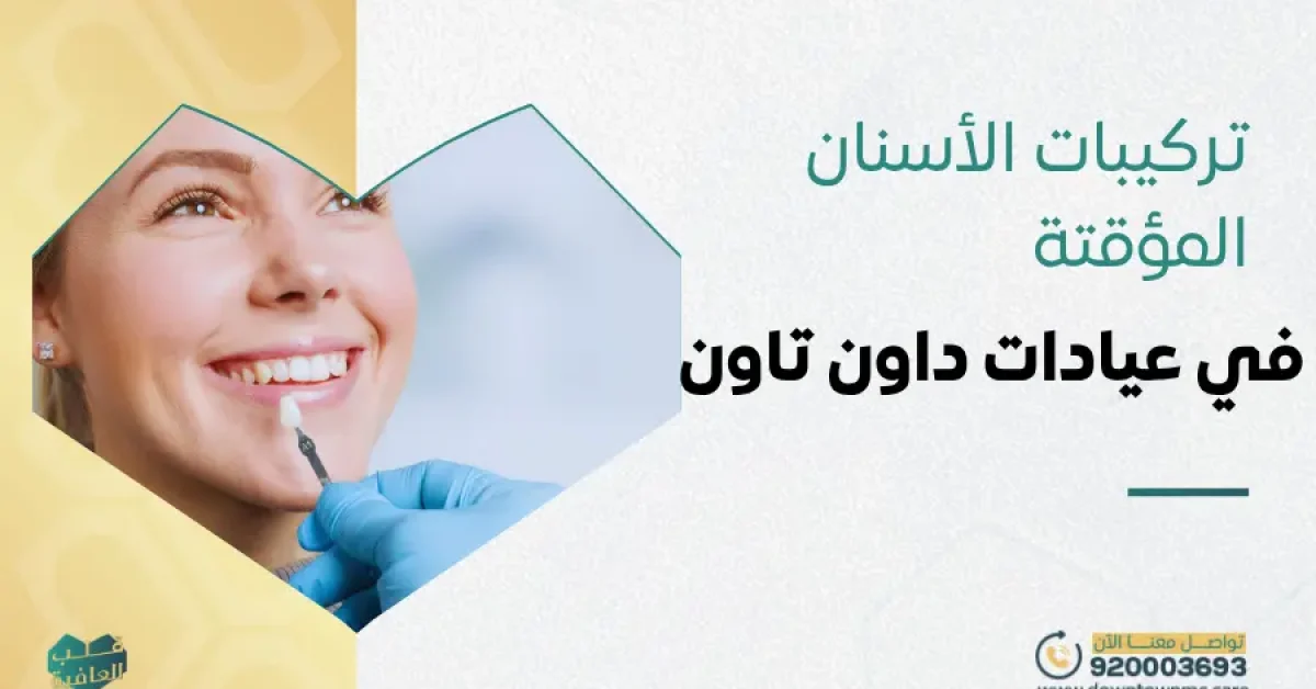تركيبات الأسنان المؤقتة