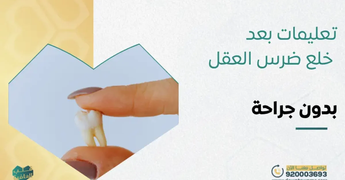 تعليمات بعد خلع ضرس العقل بدون جراحة