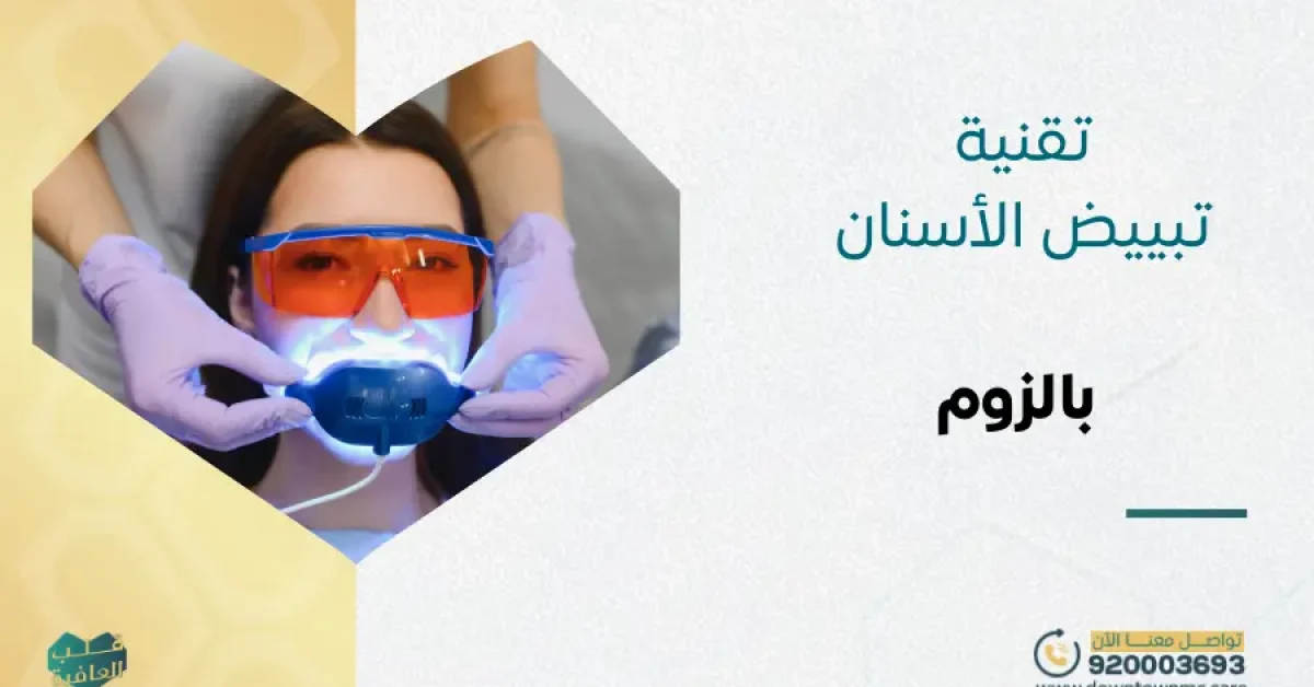 تقنية تبييض الأسنان بالزوم: المزايا والعيوب والخطوات