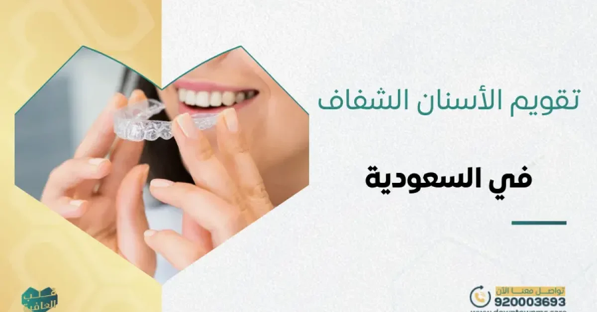 تقويم الأسنان الشفاف​ في السعودية