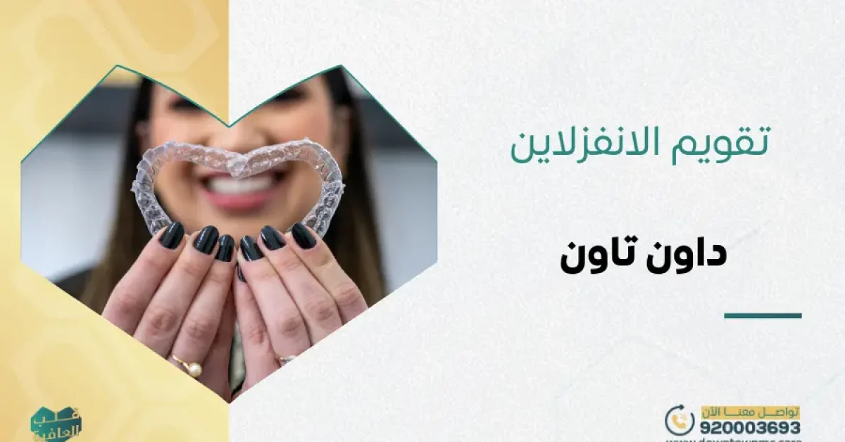 تقويم الانفزلاين في داون تاون