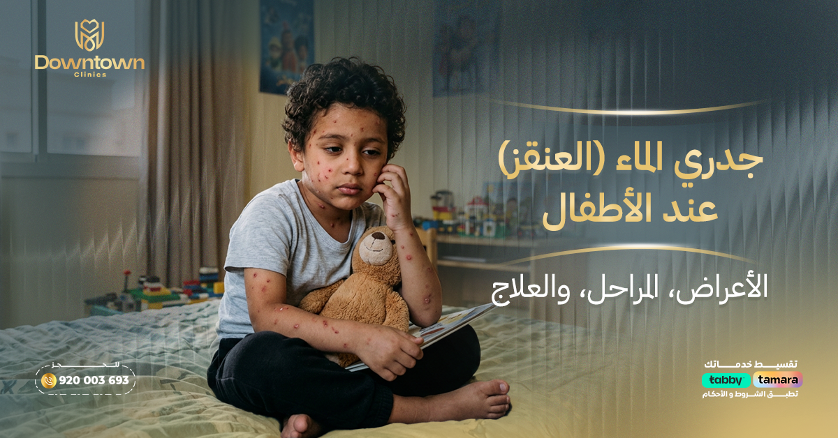جدري الماء (العنقز) عند الأطفال الأعراض، المراحل، والعلاج