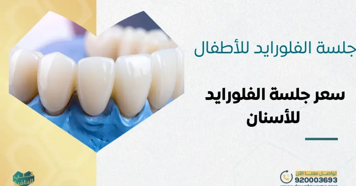 جلسة الفلورايد للأطفال: سعر جلسة الفلورايد للأسنان