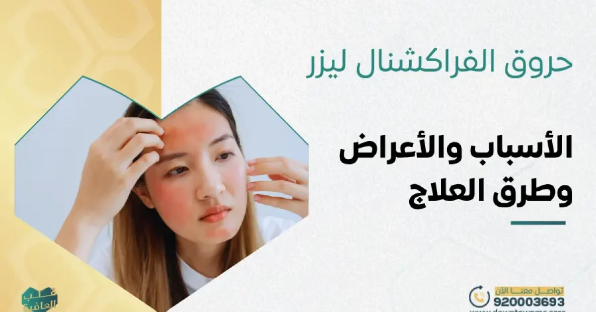 حروق الفراكشنال ليزر