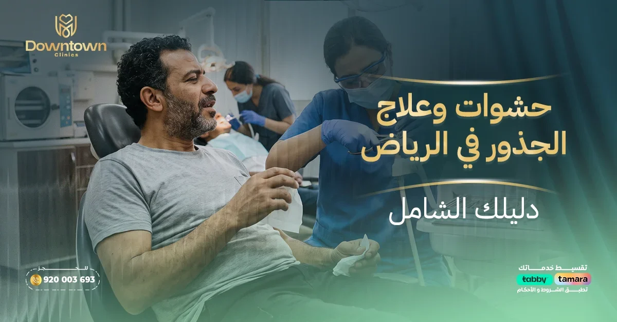 حشوات وعلاج الجذور في الرياض - دليلك الشامل