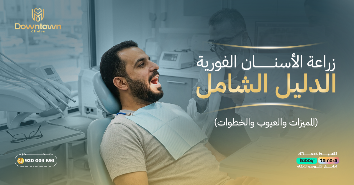 زراعة الأسنان الفورية الدليل الشامل (المميزات والعيوب والخطوات)