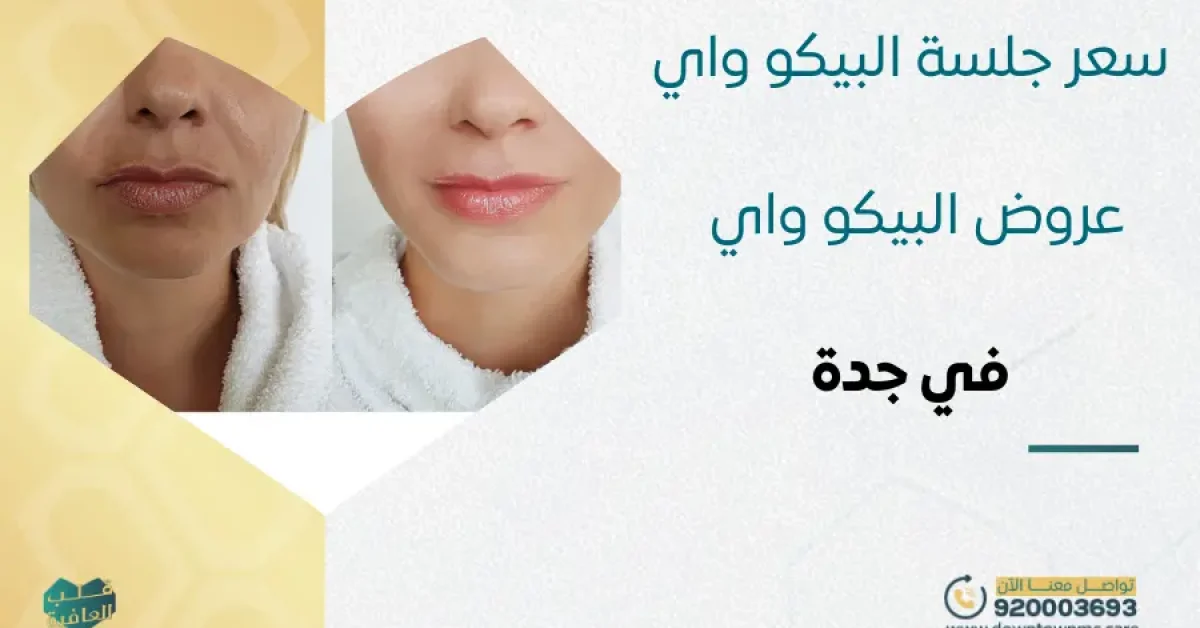 سعر جلسة البيكو واي | أفضل عروض جهاز البيكو واي في جدة