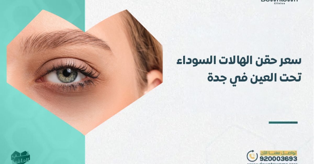 سعر حقن الهالات السوداء تحت العين في جدة