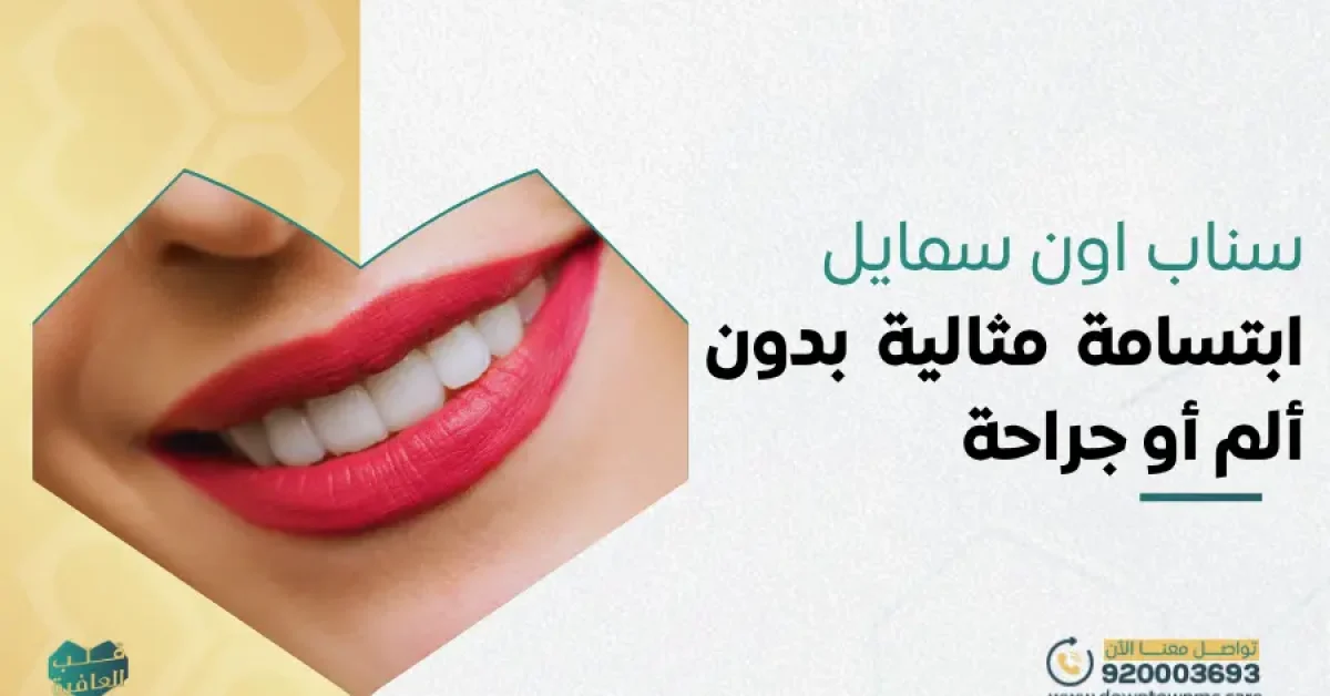 سناب اون سمايل