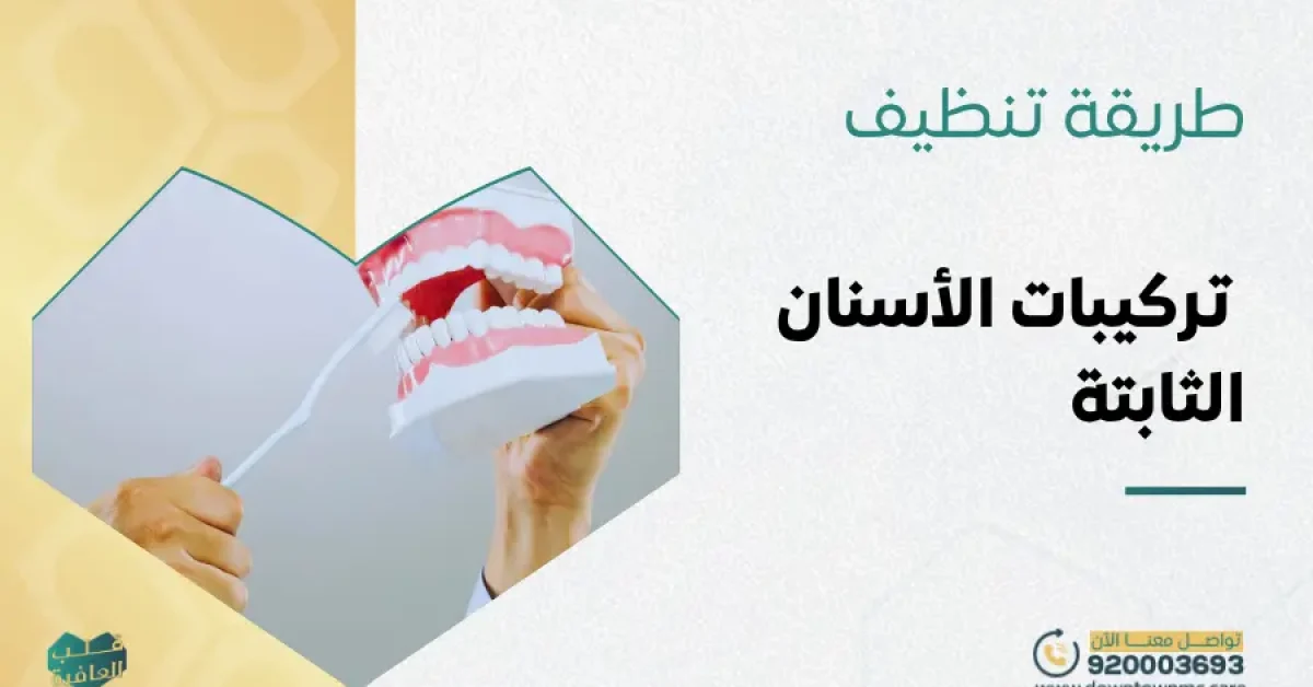 طريقة تنظيف تركيبات الأسنان الثابتة