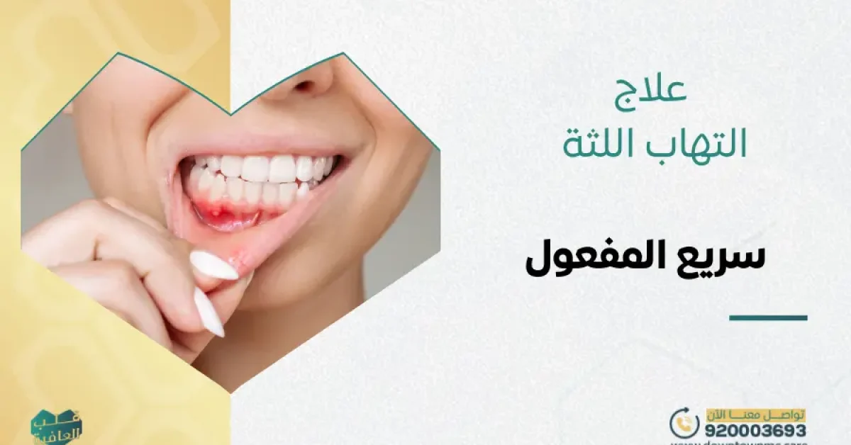 علاج التهاب اللثة سريع المفعول في داون تاون السعودية
