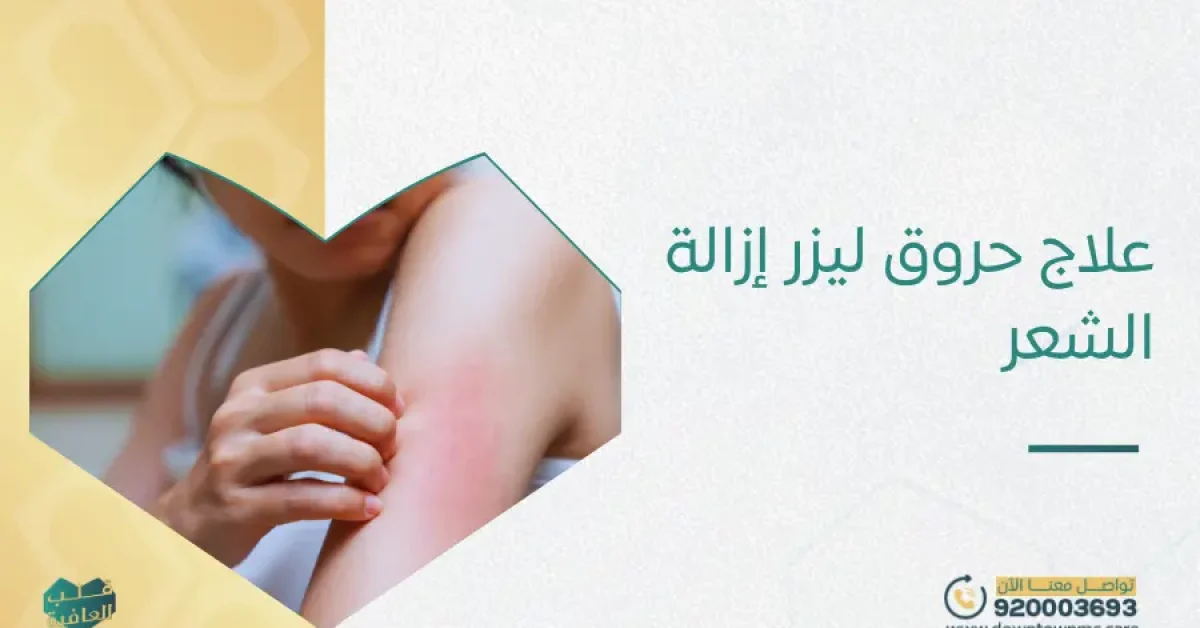 علاج حروق ليزر إزالة الشعر